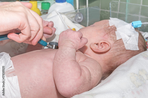 Fotografia, Obraz Doctor doing auscultation newborn baby with peripheral intravenous catheter in t