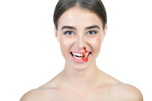 Laughing Young Beautiful Woman With Bleeding Broken Nose. Nosebleed. Violence In Family, Pain, Weak Blood Vessels Concept