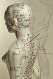 Fototapeta  - female acupuncture model with needles in the shoulder