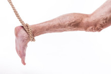 Rope Holding Human Leg Ailing Varicose Veins Of The Lower Extremities And Venous Thrombophlebitis And On A White Background, With Depth Of Field Photo