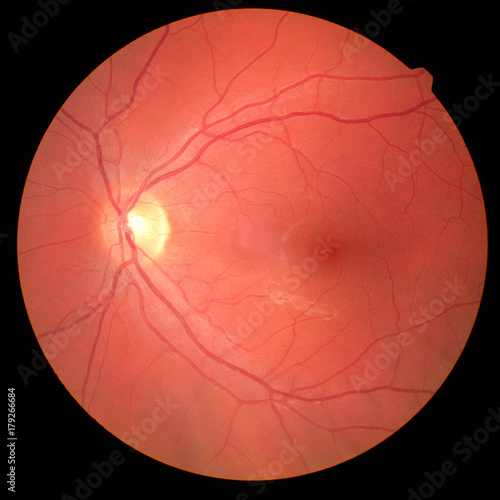 Fotografía right eye's retinal image with macula, vessels and optic disc isolated view on a