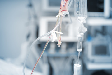 Intravenous drip system on the view of advanced medical equipment in the hospital ward