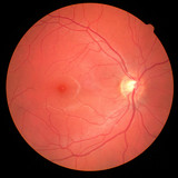 Fototapeta Las - left eye's retinal image with macula, vessels and optic disc isolated view on a black bacground