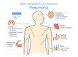 Main symptoms of infectious Pneumonia. Illustration about diagram for health check up.