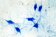 Light Micrograph Of Human Brain Tissue Showing Neurons And Glial Cells
