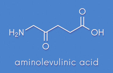 Poster - d-aminolevulinic acid (ALA) drug molecule. Used in diagnosis and treatment (photodynamic therapy) of cancer. Skeletal formula.