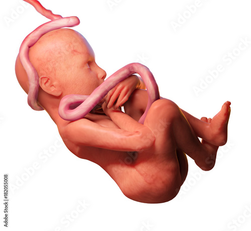 Human Fetus With Umbilical Cord Around The Neck Isolated On White Background Stock Illustration Adobe Stock