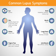 Common Lupus Symptoms Vector Logo Icon Illustration