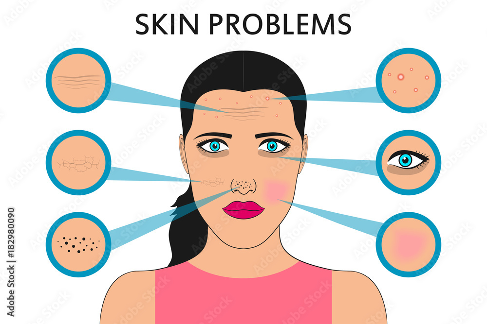 Female face skin problems. Acne and pimples, black spots, redness ...
