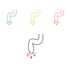 vector illustration of a prolapsed hemorrhoid veins