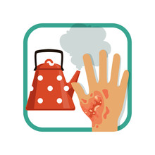 Illustration Showing Third Degree Burn Of Hand. Severe Burns Skin From Kettle. Thermal Injury. Flat Vector Design Element For Card, Brochure Or Poster