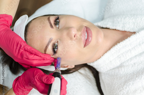 Photographie Dermapen mesotherapy on female face in spa