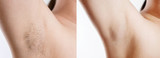 Fototapeta Koty - Woman with armpit hair, female hairy armpit, clean woman armpit, before and after shaving