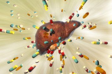 Wall Mural - Conceptual image of drug-induced hepatotoxicity, 3D illustration