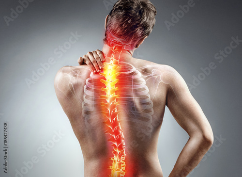 Fotomural Young man holding his neck in pain. Medical concept.