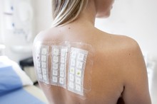 Patient Undergoing A Patch Test In Allergy Clinic