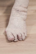 closeup of a senior person's left foot with arthritis, damaged nails