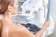 Woman undergoing medical mammography scan