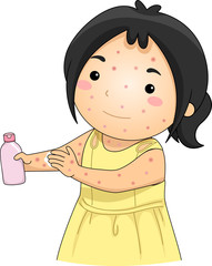 Wall Mural - Kid Girl Chicken Pox Unscented Lotion Illustration