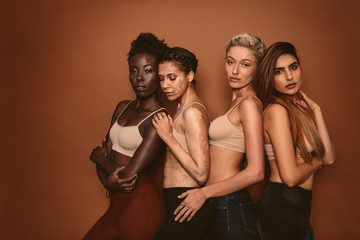 Wall Mural - group of four young diverse girls