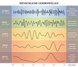 Ondes Cérébrales Humaines Diagramme / Illustration Multicolore - Texte et Explications en Allemand