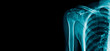 banner x-ray shoulder