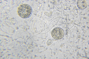 Chlamydomonas algae, paramecium ciliates and many bacteria through microscope