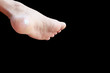 © pramot48 - close up pain foot corn isolated on black background with clipping path