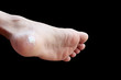 © pramot48 - close up pain foot corn isolated on black background with clipping path