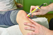 © dobok - Laser therapy. Physical therapist treating patient knee