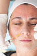 © aerogondo - close up of a young woman having mesotherapy treatment