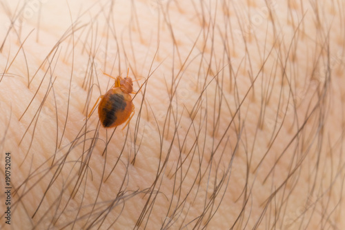 Fotografía Bed bug creeps on the body of a person in a macro