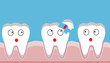 tooth fracture, filling, teeth, trauma, vector 