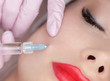 The doctor cosmetologist makes the Rejuvenating facial injections procedure for tightening and smoothing wrinkles on the face skin of a beautiful woman in a beauty salon.Cosmetology skin care.