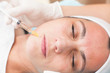 © aerogondo - close up of a young woman having mesotherapy treatment