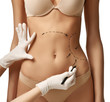 Female body with the drawing arrows on tummy for plastic surgery  liposuction 