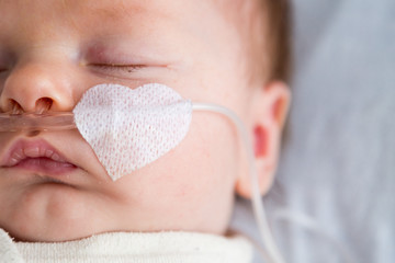 newborn baby in hospital weakened with bronchitis is getting oxygen via nasal prongs to assure oxyge