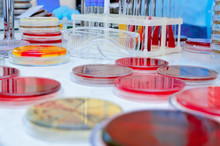 Petri Dish. Microbiological Laboratory. Mold And Fungal Cultures. Bacterial Research