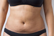 © Imagenatural - Fat belly