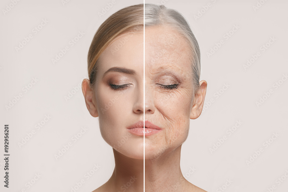 Comparison. Portrait of beautiful woman with problem and clean skin, aging and youth concept, beauty treatment - obrazy, fototapety, plakaty 