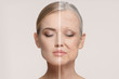 Leinwandbild Motiv Comparison. Portrait of beautiful woman with problem and clean skin, aging and youth concept, beauty treatment