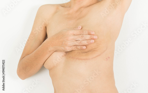 Fotomural Breast Cancer Surgery in woman