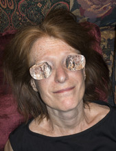 Woman With Ice On Eyes