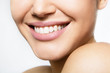 © Khorzhevska - Laughing woman mouth with great teeth over white background. Healthy beautiful female smile. Teeth health, whitening, prosthetics and care.