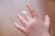 © sergeevspb - plaster on the finger of the child