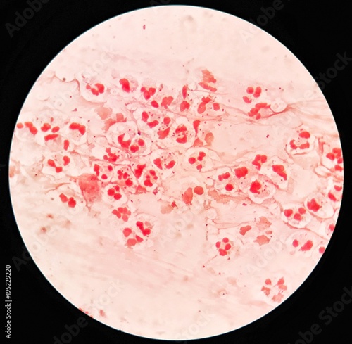 Gram Negative Cocci In Clusters