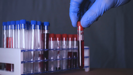 Lab work, a man holds test tubes in blue rubber gloves, analysis, dna, a test tube stand.