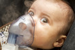 © jollier_ - Inhalation child infant under one year