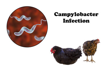 Wall Mural - Chicken meat as the source of Campylobacter infection, medical concept. 3D illustration showing chicken and close-up view of Campylobacter bacteria