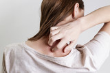 Fototapeta  - Close up view of woman scratching her neck.